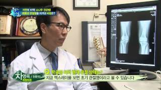 퇴행성 관절염을 이겨낸 비법은?
