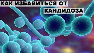 КАК ИЗБАВИТЬСЯ ОТ КАНДИДОЗА.ГРИБОК КАНДИДА ВО РТУ,В ГОРЛЕ,В КИШЕЧНИКЕ.