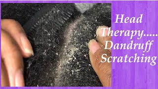 Bored? Watch This! BIG Dandruff Flakes Scratching/Head Therapy ??‍♀️