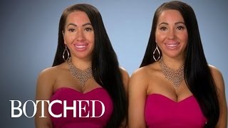 Identical Twins Mad Over 'Unidentical' Boobs! | Botched | E!