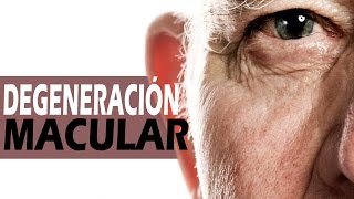Degeneración macular Remedios naturales