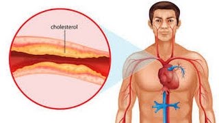 5 Foods That Lower Cholesterol Naturally