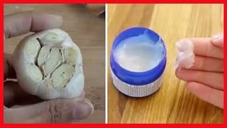 LAS HEMORROIDES ➜ Elimina las HEMORROIDES Fácilmente Sin Tratamientos Largos, 100% Natural