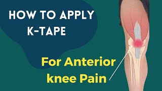 How to apply Kinesiology tape for knee pain - Patella Femoral Syndrome / Osgood Schlatters Syndrome