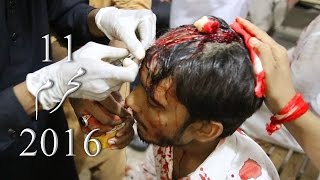 Azadar getting treatment after Quma Zani 11 Muharram 2017
