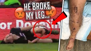 He Broke My Leg At KSI's Soccer Event (serious injury)