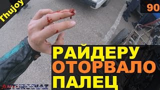 Мотоциклисту оторвало палец 18+