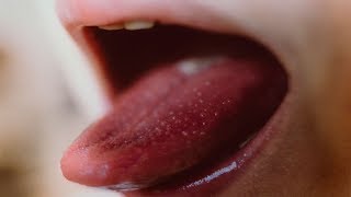 10 Common HIV Symptoms In Women That You Shouldn't Ignore