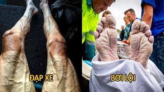 Những bộ phận cơ thể biến dạng của các VĐV ở những môn thể thao khác nhau