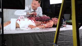 Autopsy of Becca