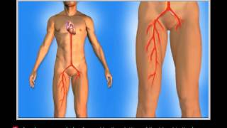 Causes for Wolff Parkinson-White Syndrome
