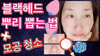 블랙헤드를 완전히 제거하는 전문가적인 방법. 블랙헤드 없애는 방법. 블랙헤드 녹이는 제품. 블랙헤드 압출. 모공 줄이는 방법. 모공축소. 피지 제거 방법.