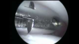 Dogs Shoulder, OCD . Артроскопия плечевого сустава у собаки www.endovet.com
