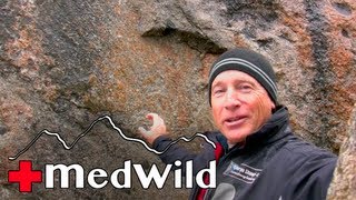 Wilderness Medicine: Eye Problems at Altitude