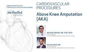 Above Knee Amputation (AKA) - (Maham Rahimi, MD, PhD, RPVI & Kaled Diab, MD)