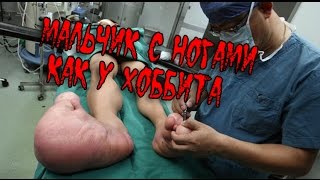 Ужас! МАЛЬЧИК С НОГАМИ КАК У ХОББИТА