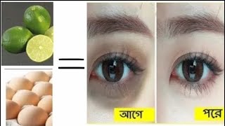 চোখের কালো দাগ দূর করুন। BD unique Lifestyle.