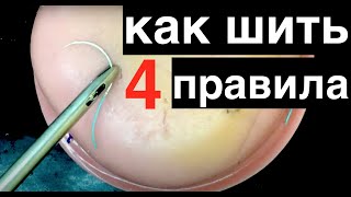 4 правила шитья в лапароскопии. Laparoscopic suturing rules by Zhaugashev. suturing technique