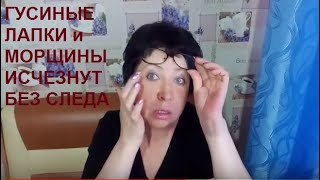 АПТЕЧНАЯ МАЗЬ Убирает Морщины, ГУСИНЫЕ лапки и ПОДТЯГИВАЕТ кожу вокруг глаз!МОЙ ОТЗЫВ