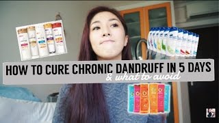 How to cure Chronic Dandruff in 5 days, SUPER EFFECTIVE