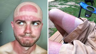 60 смешных и неудачных загаров (часть 2)