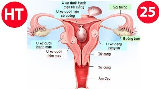 Mẹo chữa đau đầu dương vật, tử cung, đau bụng kinh, gót chân | mẹo vặt chữa bệnh