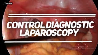 Контрольна діагностична лапароскопія | Control diagnostic laparoscopy