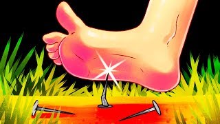 サビた釘で足を刺すとどうなる？