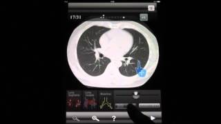 Radiology : Chest CT Sectional Walker