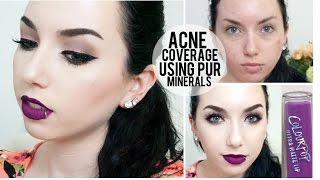 ACNE COVERAGE | Pur Minerals, Maybelline Better Skin Concealer & NEW Colour Pop Ultra Matte Lipstick