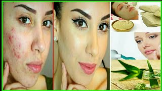 पिम्पलस दूर करने के उपायhow to remov pimples over night,Remov pimples permanently