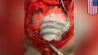 하버드 대학 연구팀, 약한 심장을 지탱해줄 수 있는 로봇심장슬리브 개발