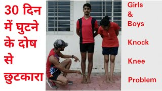 RPF Knock Knee Medical Test