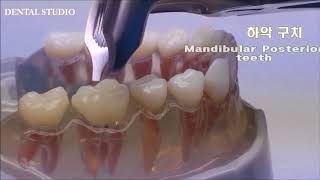 Легкие щипцы (EASY FORCEPS) от Dental Studio