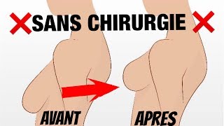 REMONTER SA POITRINE SANS CHIRURGIE ‼️
