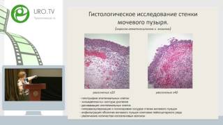 Кульченко Н Г - Лечение лучевых поражений мочевого пузыря