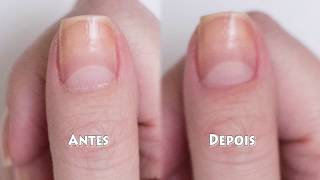 Removendo as cutículas sem alicate