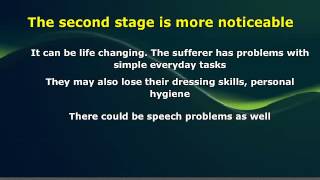 Dementia Symptoms Stages