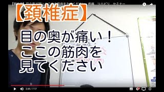 【頚椎症】目の奥が痛い！ここの筋肉をみてください　疼痛　リハビリ　セミナー