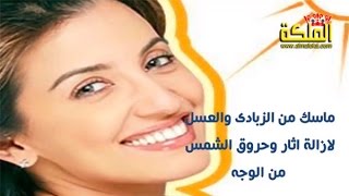 ماسك من الزبادى والعسل لعلاج حروق الشمس فى الوجه والبشرة