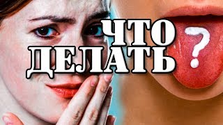 У тебя неприятный привкус во рту? О чём говорит, что делать.