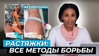 РАСТЯЖКИ: все методы борьбы// Как убрать красные и белые стрии: от кремов до медицинских методов