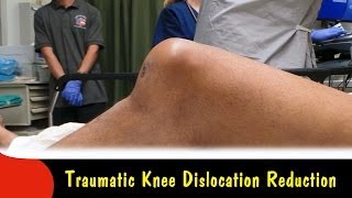 Traumatic Knee Dislocation Reduction-Quick Version