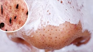 お家で作れる２５のお肌を蘇らせるマスクのアイデア