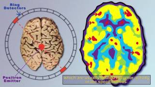Brain Imaging