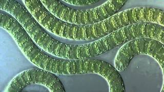 Цианобактерии/сине-зеленые водоросли под микроскопом [Cyanobacteria under microscope]