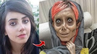 Estetik Yüzünden Tanınmaz Hale Gelen Ünlüler!