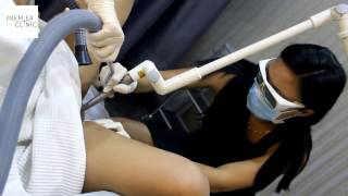 Laser Vaginal Rejuvenation