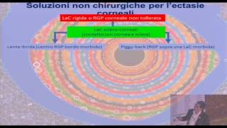 Salvatore Pintus - Cheratocono, effetti Ottici - Convegno SOPTI 2017O