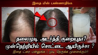 தலைமுடி அடர்த்தி குறையுதா ?முன்நெற்றியில் சொட்டை ஆயிருச்சா இதை பன்னுங்க |hair growth tips
